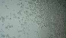 Metodi efficaci per combattere la muffa sui muri