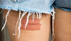 Metodi efficaci e naturali per il trattamento delle ferite purulente