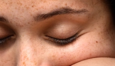 Perché compaiono le macchie marroni sulla pelle e come prevenirle?